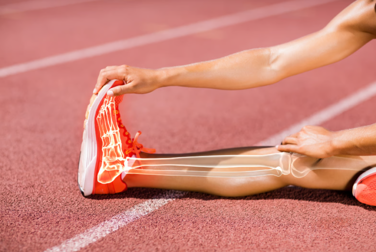 Reduced energy availability: implications for bone health in physically active populations